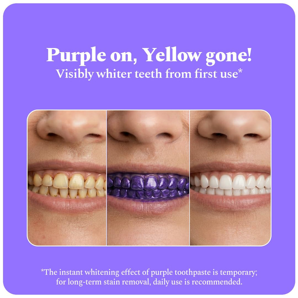 Perfora Purple Whitening Toothpaste-75g | Purple Toothpaste For Teeth Whitening | Teeth Stain Remover | Enamel Safe & Effective Teeth Whitener Oral care | Grape Mint
