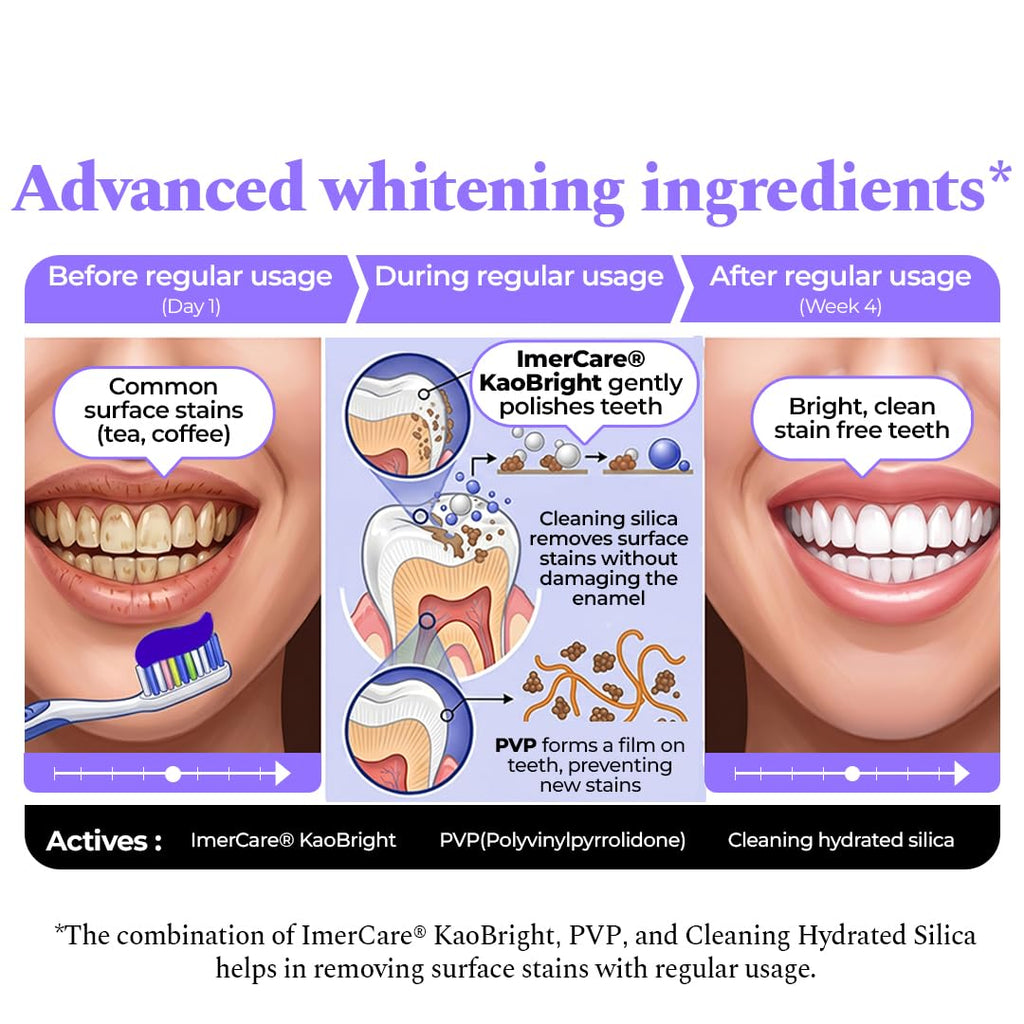 Perfora Purple Whitening Toothpaste-75g | Purple Toothpaste For Teeth Whitening | Teeth Stain Remover | Enamel Safe & Effective Teeth Whitener Oral care | Grape Mint