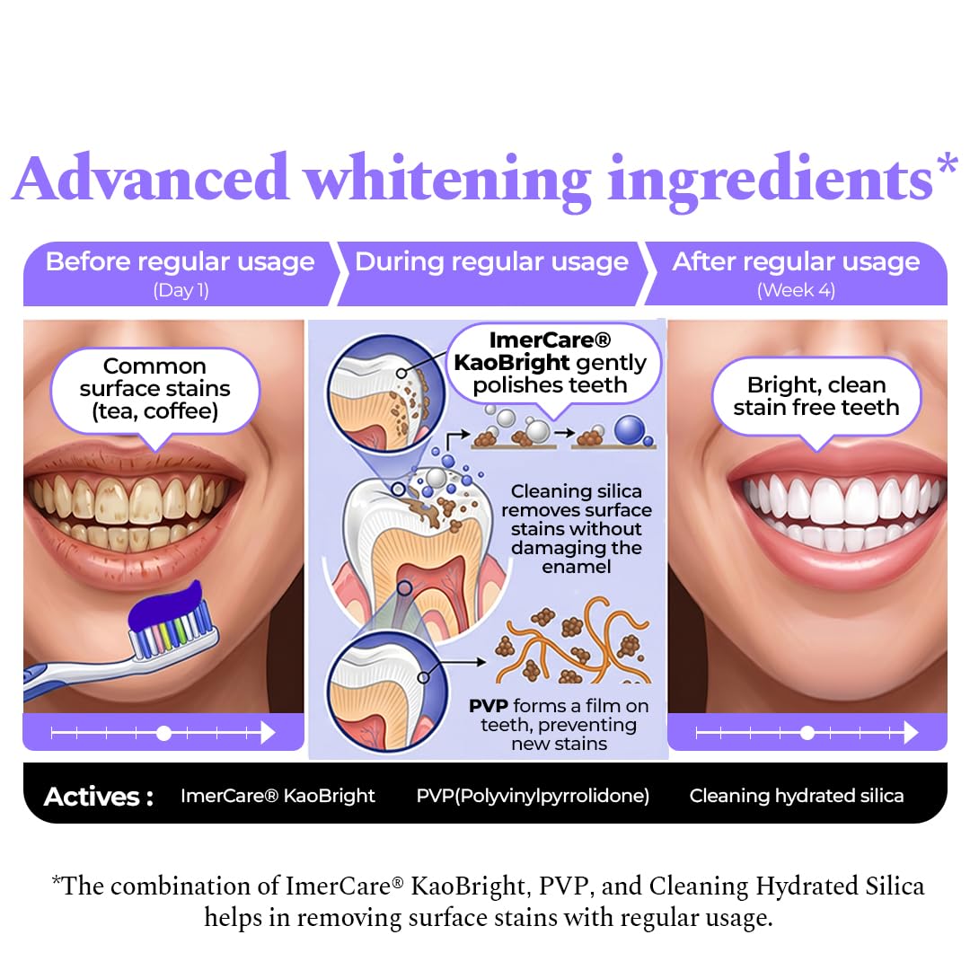 Perfora Purple Whitening Toothpaste-75g | Purple Toothpaste For Teeth Whitening | Teeth Stain Remover | Enamel Safe & Effective Teeth Whitener Oral care | Grape Mint